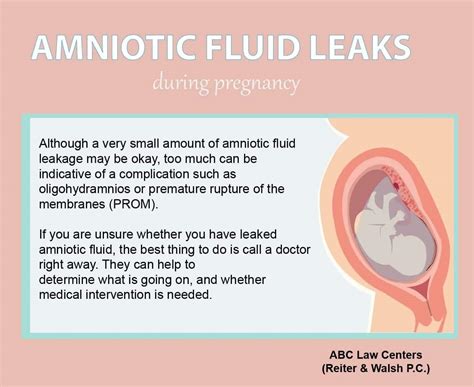 symptoms of leaking amniotic fluid|Leaking Amniotic Fluid During Pregnancy